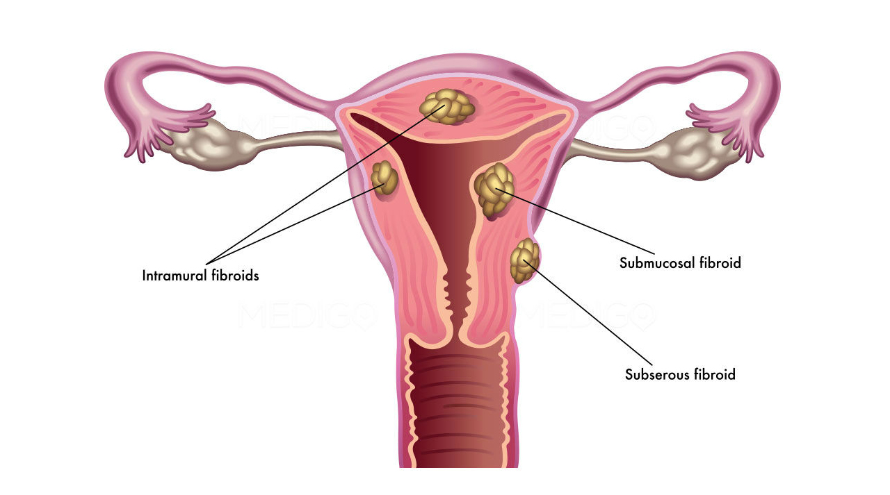 Laparoscopic Surgeon Jalandhar in Punjab